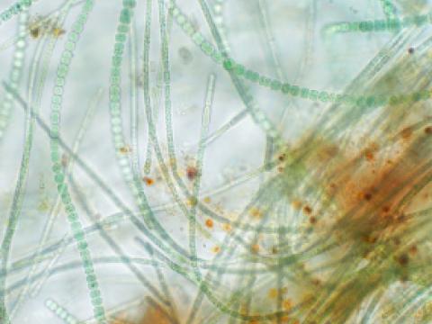 Naturally occurring algae called Anabena under a microscope
