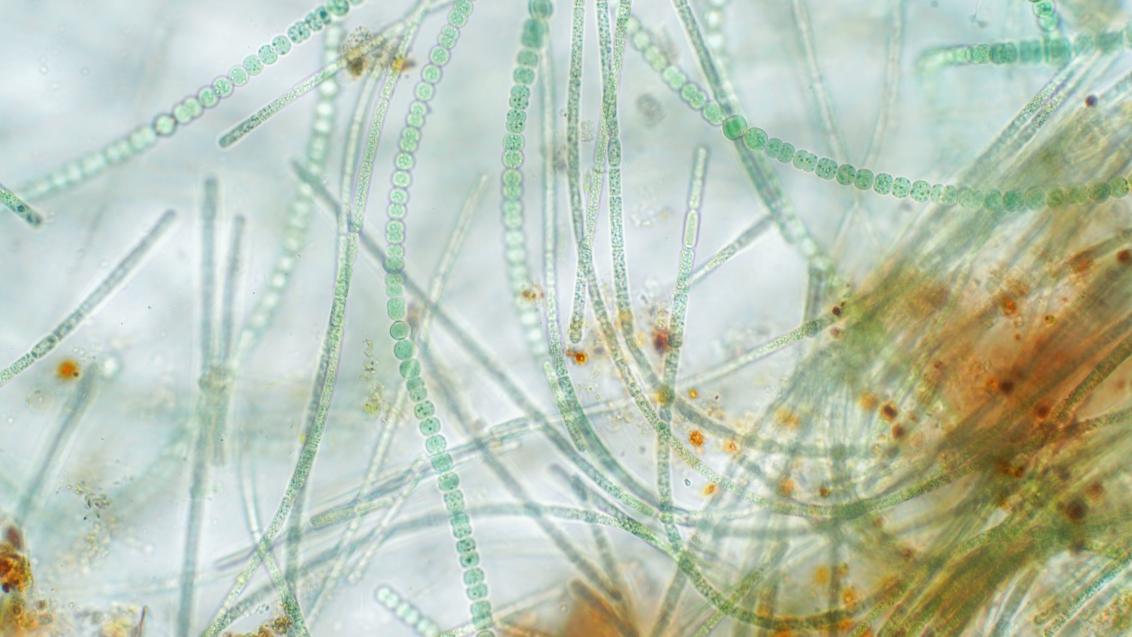 Naturally occurring algae called Anabena under a microscope