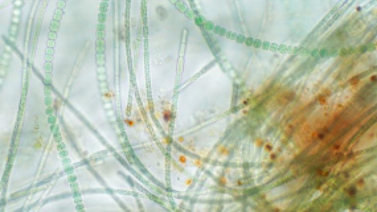 Naturally occurring algae called Anabena under a microscope